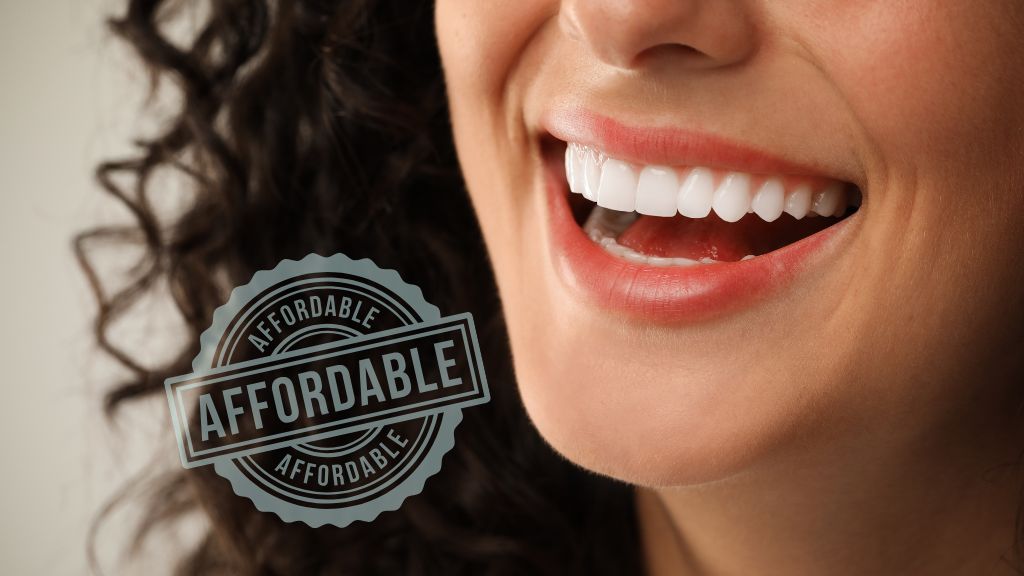 Affordable Ways to Improve Your Smile Without Breaking the Bank